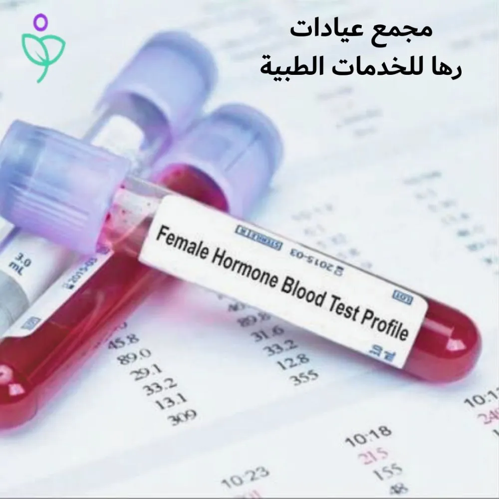 أنواع تحاليل الهرمونات للنساء